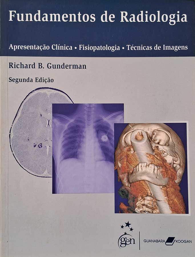 Livro Fundamentos de Radiologia. Apresentação Clínica, Fisiopatologia, Técnicas de Imagem.  Autor: Richard B. Gunderman. 