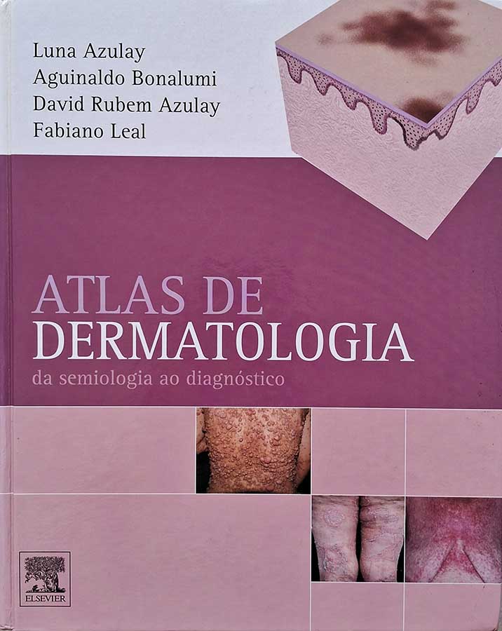 Atlas de Dermatologia. Da Semiologia ao Diagnóstico.  Autores: Luna Azulay; Aguinaldo Bonalumi; David Rubem Azulay e Fabiano Leal.   Livros usados/seminovos.  Editora: Elsevier. 