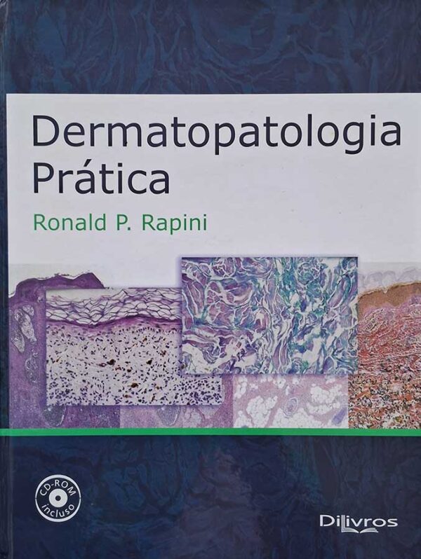 Dermatopatologia Prática.  Autor: Ronald Rapini.    Livros usados.  Editora: Di-Livros. 