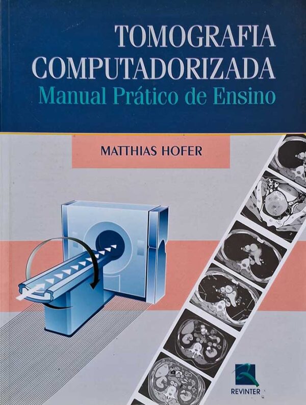 Livro Tomografia Computadorizada. Manual Prático de Ensino.  Autor: Matthias Hofer.    Livros Usados.  Editora: Revinter. 