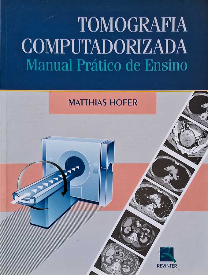 Tomografia Computadorizada: Manual Prático de Ensino/Matthias Hofer