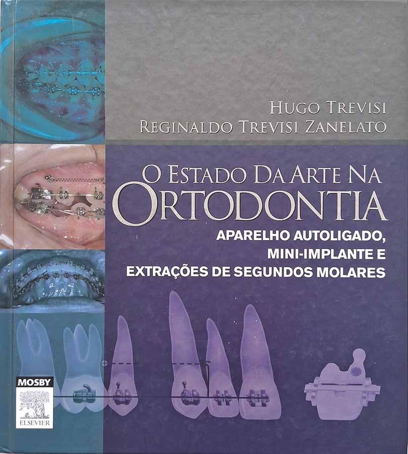 O Estado da Arte na Ortodontia (Trevisi; Zanelato)